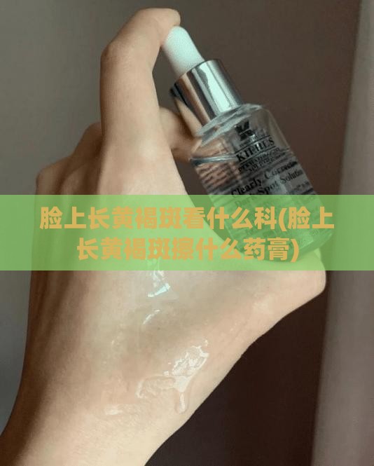 脸上长黄褐斑看什么科(脸上长黄褐斑擦什么药膏)